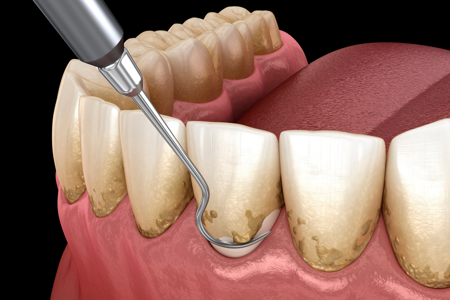 Periodoncia-TEMP