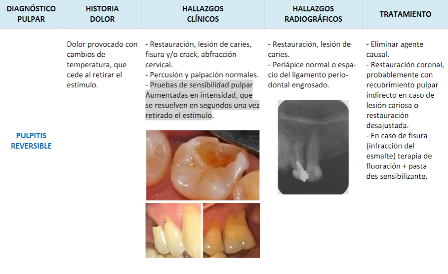 tratamiento endodoncia..